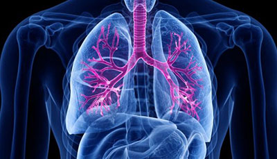 什么是慢性阻塞性肺病 (Chronic Obstructive Pulmonary Disease)，為何與新冠疫情有關(guān)？